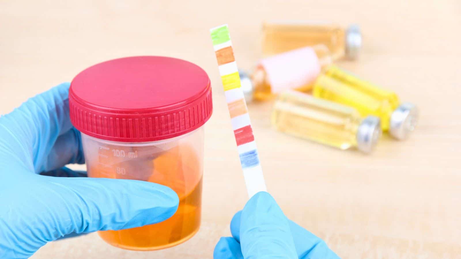 A gloved hand holds a urine sample container with a red lid and a multicolored test strip. In the background, several small vials containing different colored liquids are blurred. The setting appears to be a laboratory.